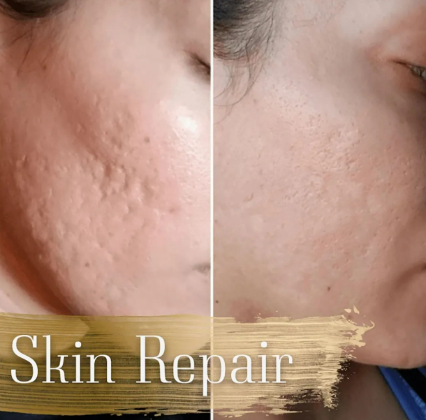 Skin Repairt ™ Suero Hidratante Placenta Koreano